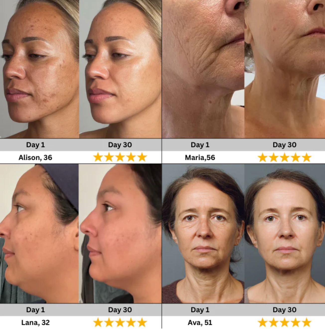 Lunara LumiLift Advanced Facial Care Device