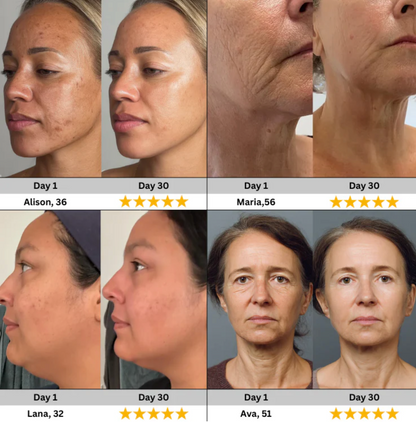 Lunara LumiLift Advanced Facial Care Device